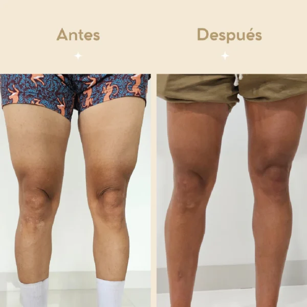 Autobronceador Corporal - Imagen 4